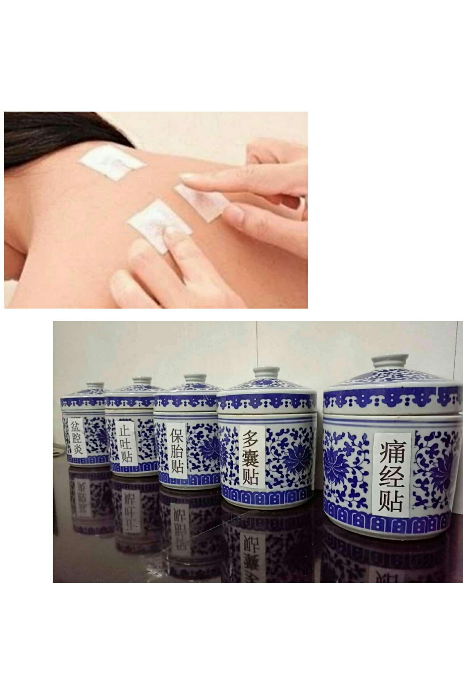 1、三伏貼能治什么?。? style=
