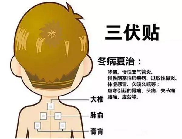 2、三伏貼的功能和功效是什么？