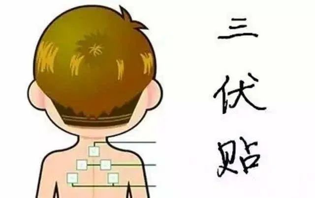 1、“兒童三伏貼”能讓孩子少生病嗎？爸爸媽媽不再盲目跟風(fēng)了。