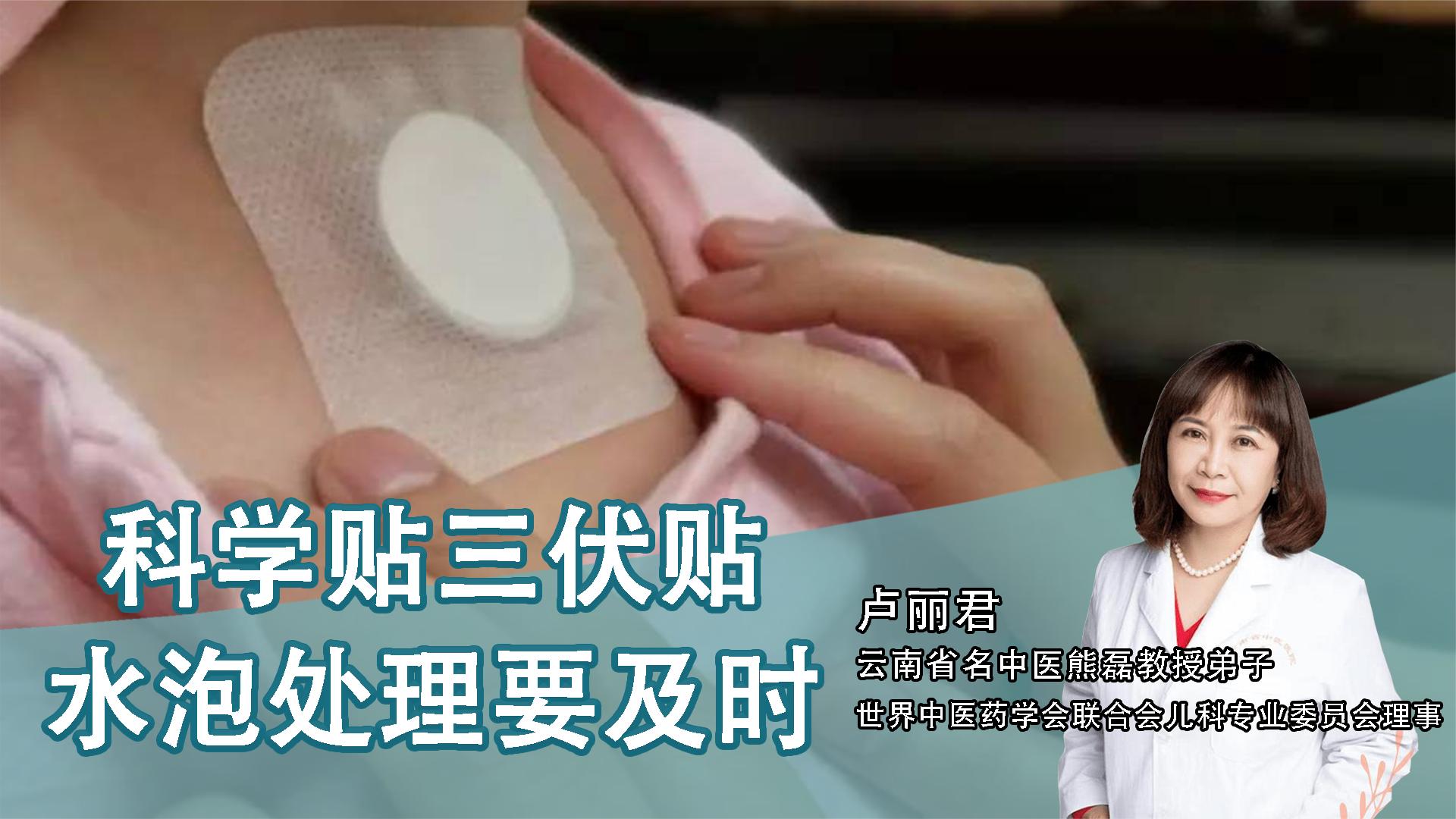 2、貼三伏貼后有什么禁忌？