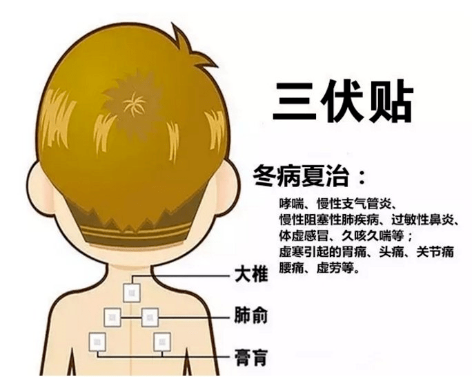 1、三伏貼多大？寶寶能貼多少？</p><p>三伏貼孩子貼多久？