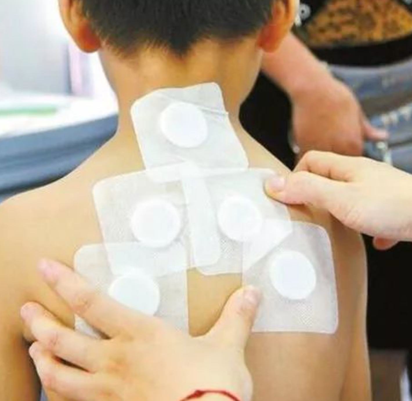 2、三伏貼在脖子上，有一根針，看起來很疼。怎么了